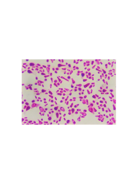 費(fèi)比恩畢赤酵母