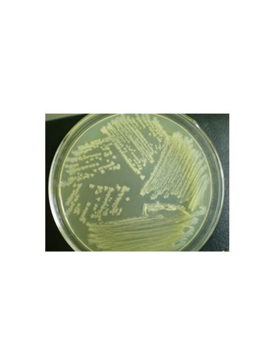 堅(jiān)強(qiáng)芽孢桿菌